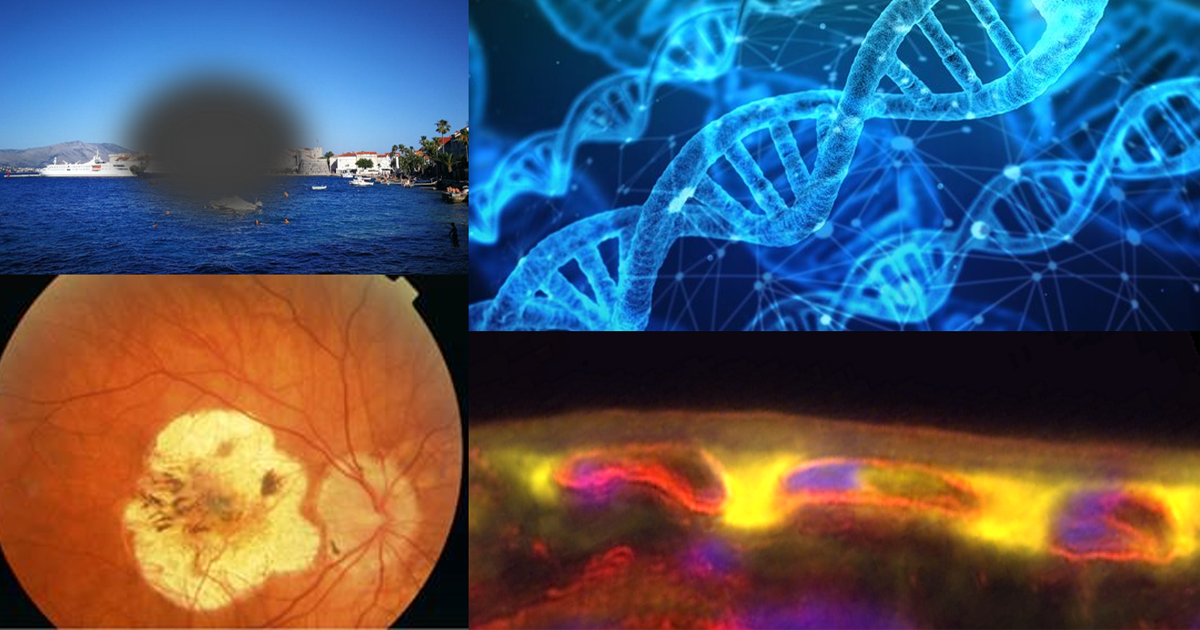 Combination of images of central vision loss, damaged macular, DNA and retinal epithelium