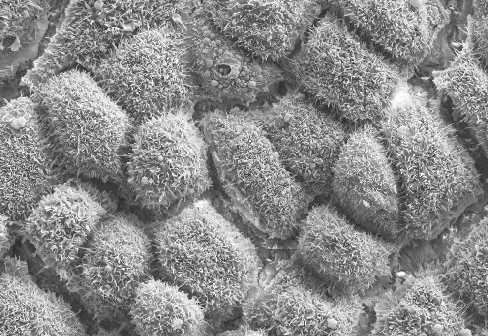 RPE cells under a microscope